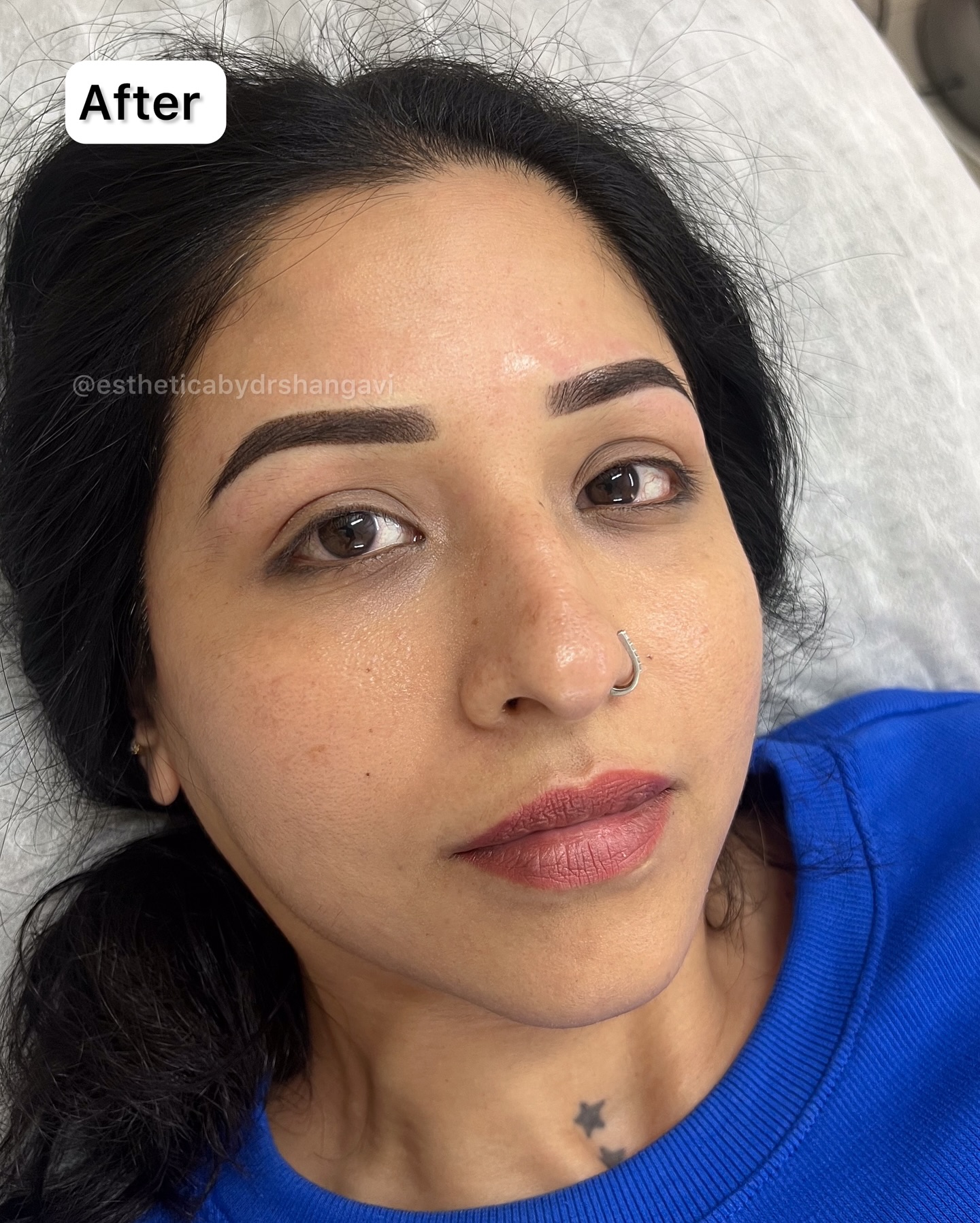 Brows Transformation