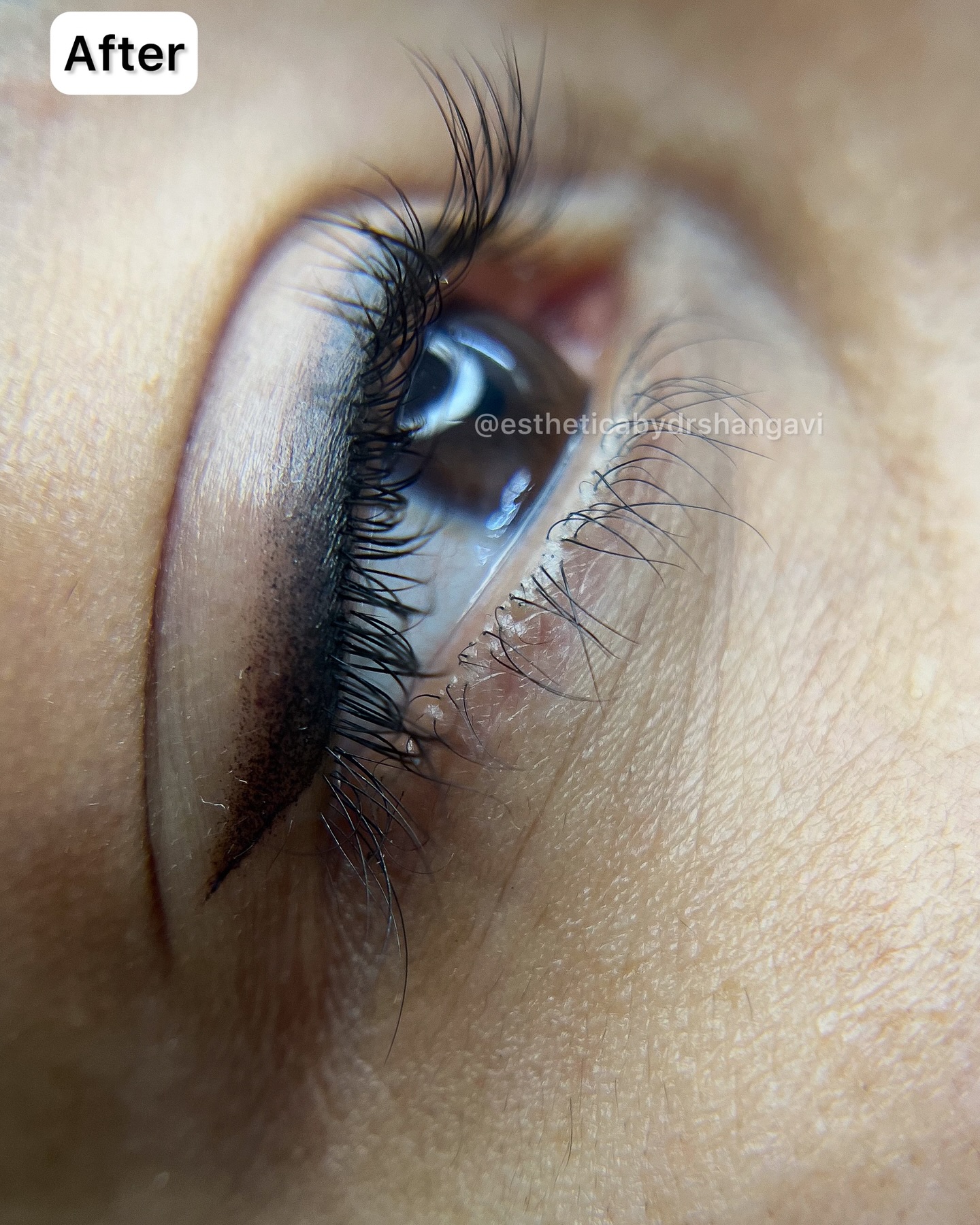 Liner Transformation