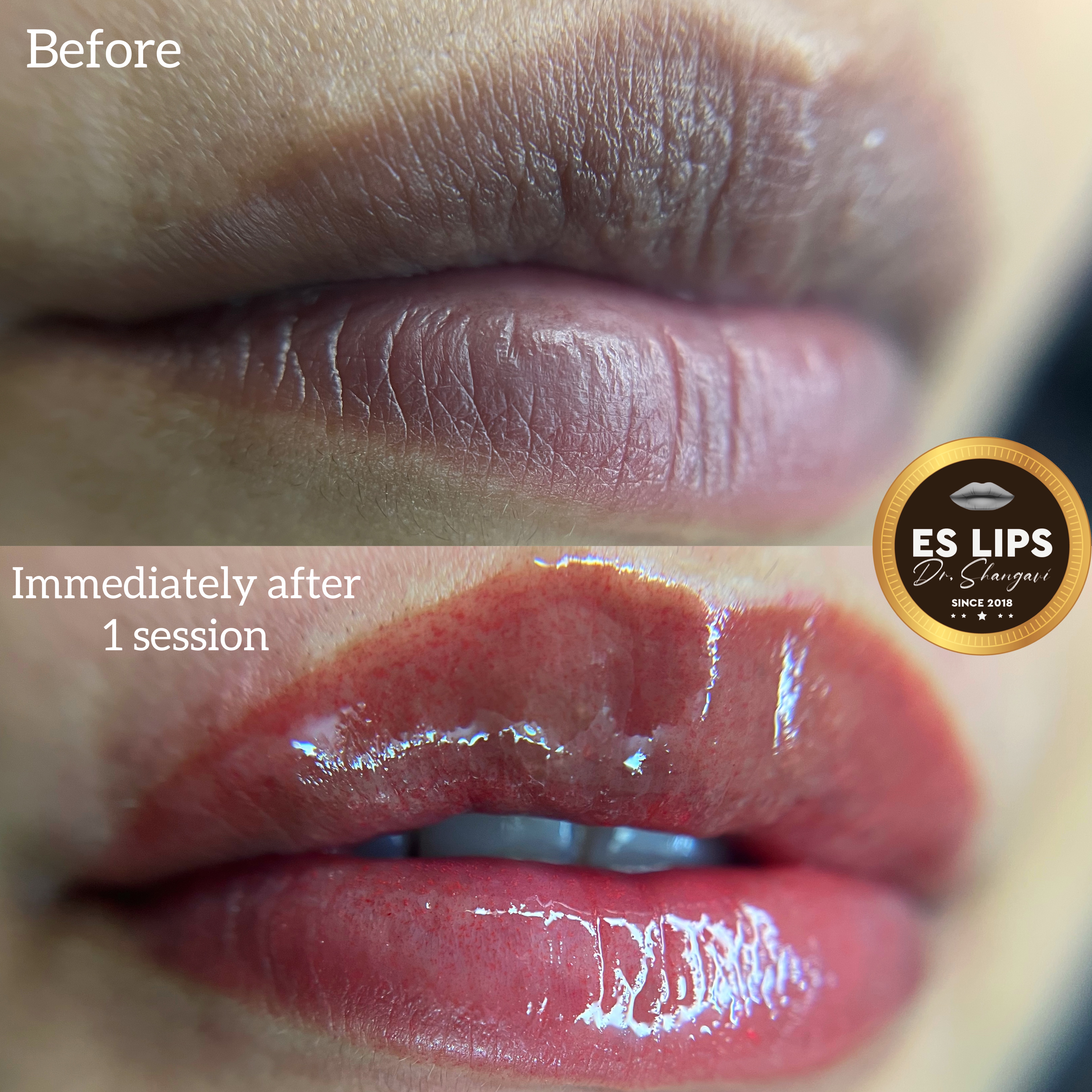 Permanent lip color Bangalore